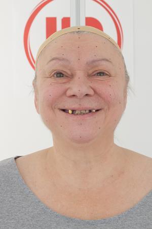 Age56-DorisAlexander/04_Smile-Mouth_Open/01_Cam01.jpg