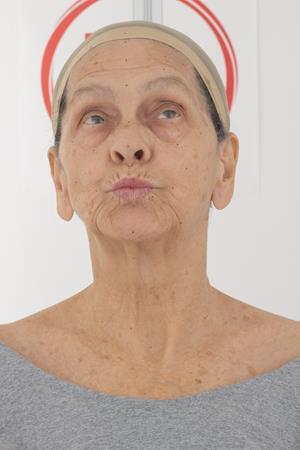 Age76-BerthaHoran/12_Pucker-Look_Up/01_Cam01.jpg