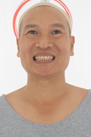 Age45-WilsonMatsui/04_Smile-Mouth_Open/01_Cam01.jpg