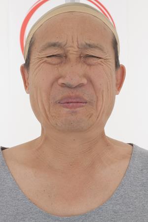 Age54-AlanTanaka/18_Pain/01_Cam01.jpg